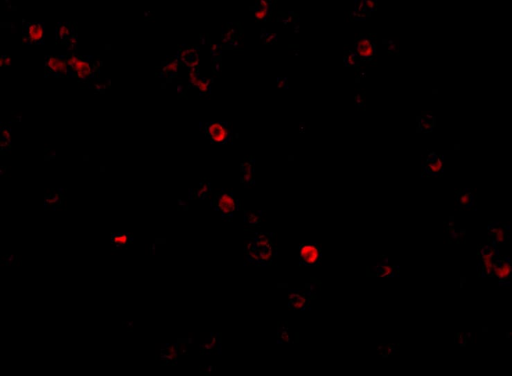 Immunocytochemistry/ Immunofluorescence: MDA5 Antibody - BSA Free [NBP1-76760] - Immunofluorescence of MDA5 in Human Lymph Node cells with MDA5 antibody at 20 ug/mL.