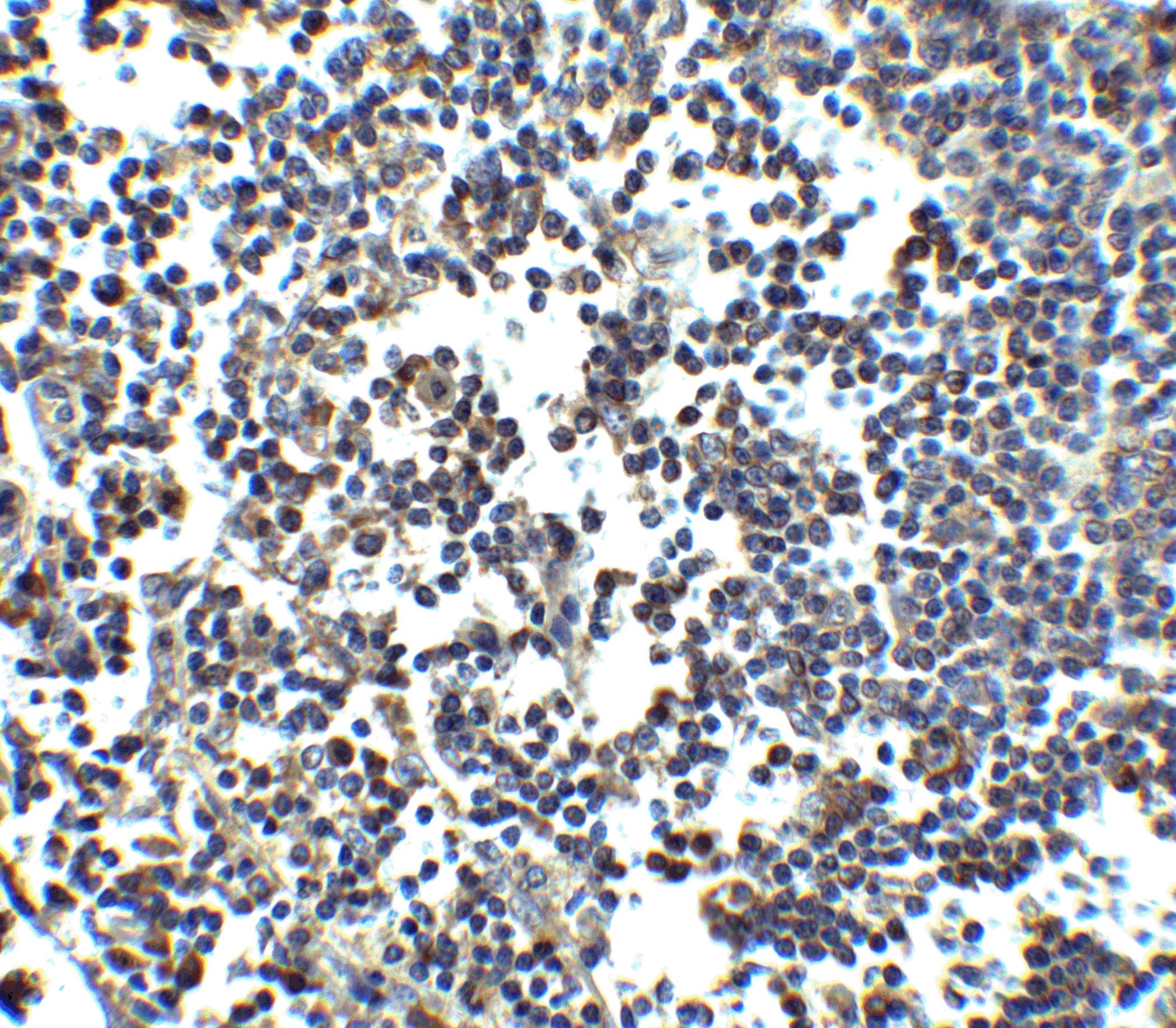 Immunohistochemistry: MDA5 Antibody - BSA Free [NBP1-76760] - Immunohistochemistry of MDA5 in human lymph node tissue with MDA5 antibody at 2.5 u/ml.