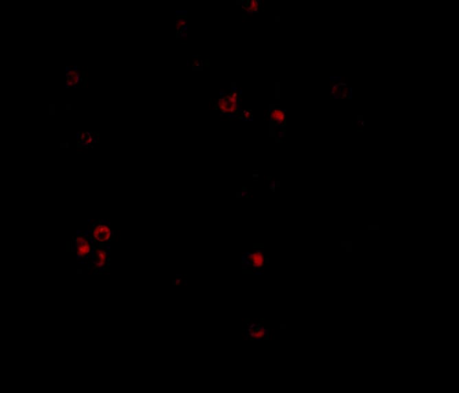 Immunocytochemistry/ Immunofluorescence: MDA5 Antibody - BSA Free [NBP1-76761] - Immunofluorescence of MDA5 in Human Lymph Node cells with MDA5 antibody at 20 u/mL.