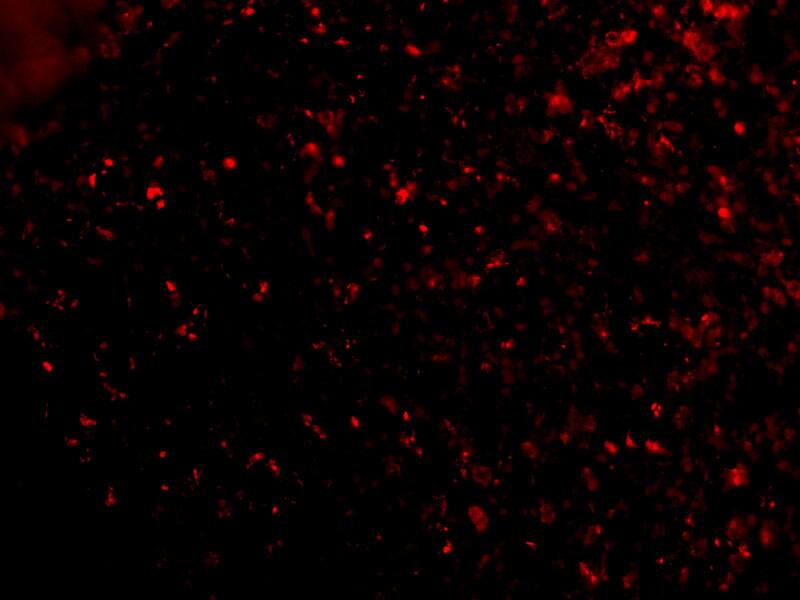 Immunocytochemistry/ Immunofluorescence: Orai1 Antibody - BSA Free [NBP1-76762] - Immunofluorescence of Orai1 in Human Spleen cells with Orai1 antibody at 20 ug/mL.