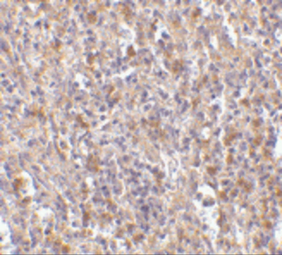 Immunohistochemistry: Orai1 Antibody - BSA Free [NBP1-76762] - Immunohistochemistry of Orai1 in human spleen tissue with Orai1 antibody at 10 u/mL. 