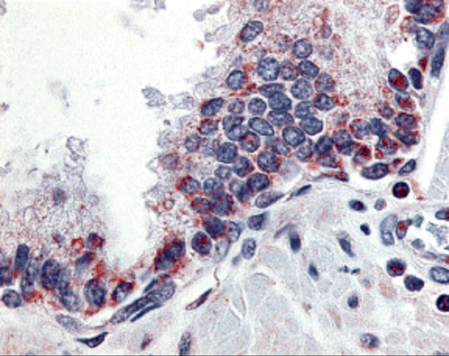 Immunohistochemistry: APRIL/TNFSF13 Antibody - BSA Free [NBP1-76767] - Immunohistochemistry of APRIL/TNFSF13 in human prostate tissue with APRIL/TNFSF13 antibody at 10 ug/mL.