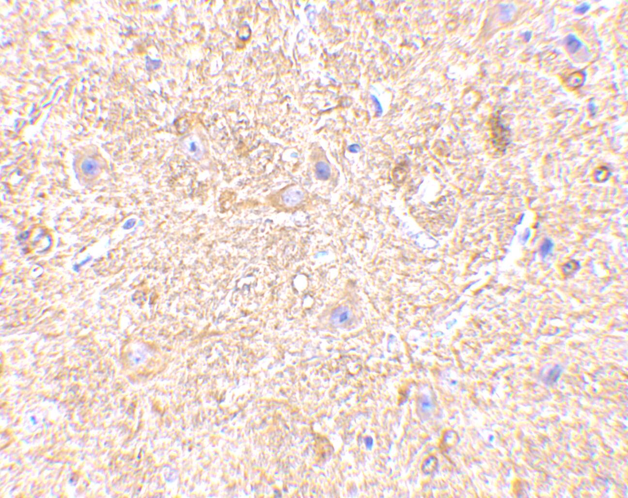 Immunohistochemistry: MAVS Antibody - BSA Free [NBP1-76768] - Immunohistochemistry of MAVS in mouse brain tissue with MAVS antibody at 2.5 u/mL.