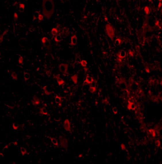 Immunocytochemistry/ Immunofluorescence: MAVS Antibody - BSA Free [NBP1-76768] - Immunofluorescence of MAVS in Mouse Brain cells with MAVS antibody at 20 u/mL.