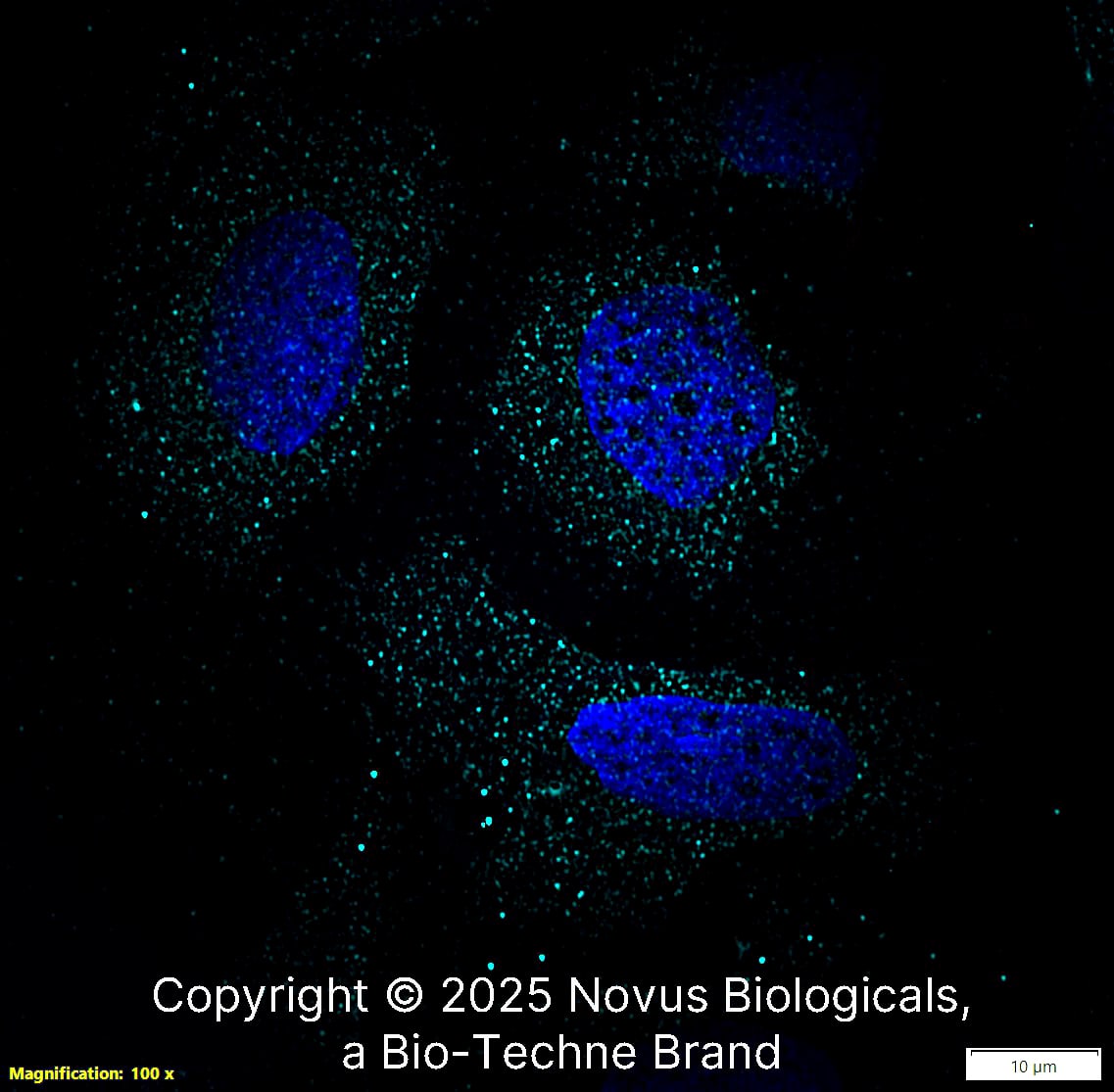 PD-L1 was detected in immersion fixed U-2 OS human osteosarcoma cell line using Rabbit anti-PD-L1 Antigen Affinity Purified Polyclonal Antibody conjugated to Alexa Fluor® 647 (Catalog # NBP1-76769AF647) (light blue) at 10 µg/mL overnight at 4C. Cells were counterstained with DAPI (blue). Cells were imaged using a 100X objective and digitally deconvolved.