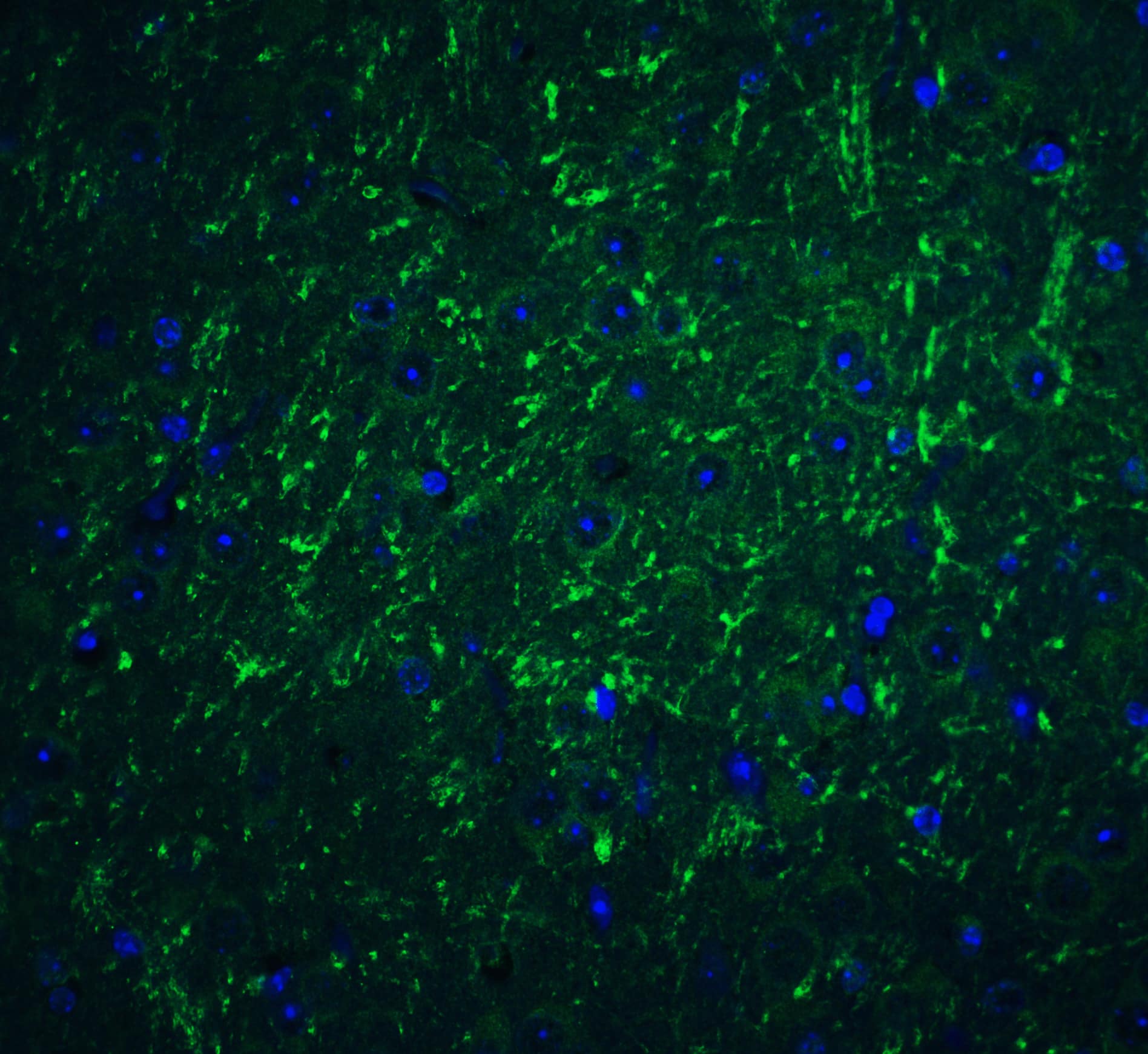 Immunocytochemistry/ Immunofluorescence: PD-L2/B7-DC/PDCD1LG2 Antibody - BSA Free [NBP1-76770] - Validation of PD-L2/B7-DC/PDCD1LG2 in Mouse Brain Tissue. Immunofluorescent analysis of 4% paraformaldehyde-fixed mouse brain tissue labeling PD-L2/B7-DC/PDCD1LG2 with  at 20 ug/mL, followed by goat anti-rabbit IgG secondary antibody at 1/500 dilution (green) and DAPI staining (blue).  