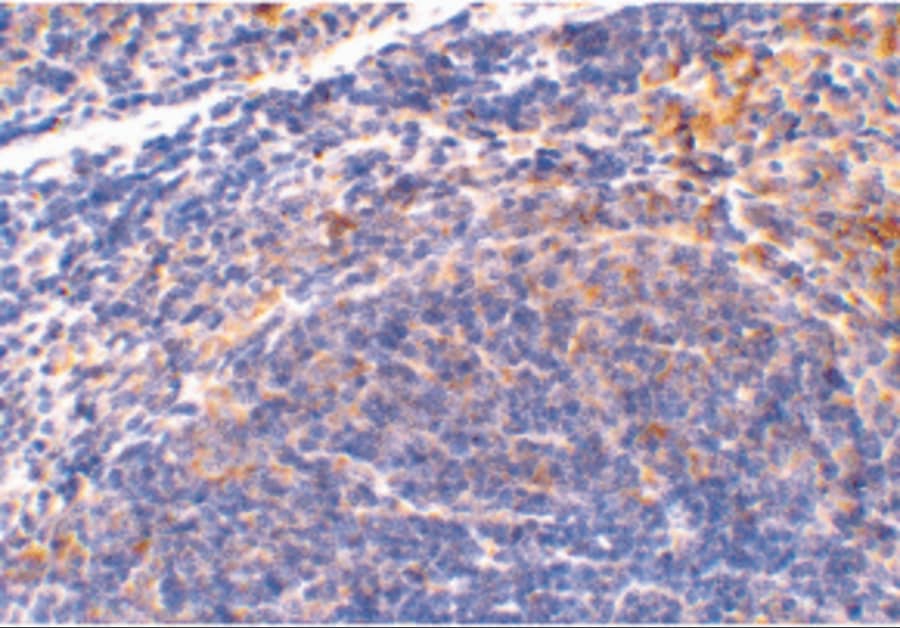 Immunohistochemistry: SMAC/Diablo Antibody - BSA Free [NBP1-76772] - Figure 5 Immunohistochemistry Validation of SMAC/Diablo in Mouse Spleen Tissue  Immunohistochemical analysis of paraffin-embedded Mouse Spleen Tissue using anti-SMAC/Diablo antibody  at 2 u/ml. Tissue was fixed with formaldehyde and blocked with 10% serum for 1 h at RT; antigen retrieval was by heat mediation with a citrate buffer (pH6). Samples were incubated with primary antibody overnight at 4C. A goat anti-rabbit IgG H&L (HRP) at 1/250 was used as secondary. Counter stained with Hematoxylin.