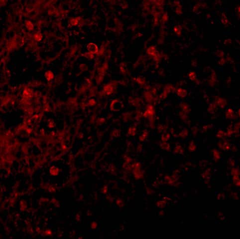 Immunocytochemistry/ Immunofluorescence: BCMA/TNFRSF17 Antibody - BSA Free [NBP1-76774] - Immunofluorescence of BCMA/TNFRSF17 in Human Spleen tissue with BCMA/TNFRSF17 antibody at 10 u/mL.