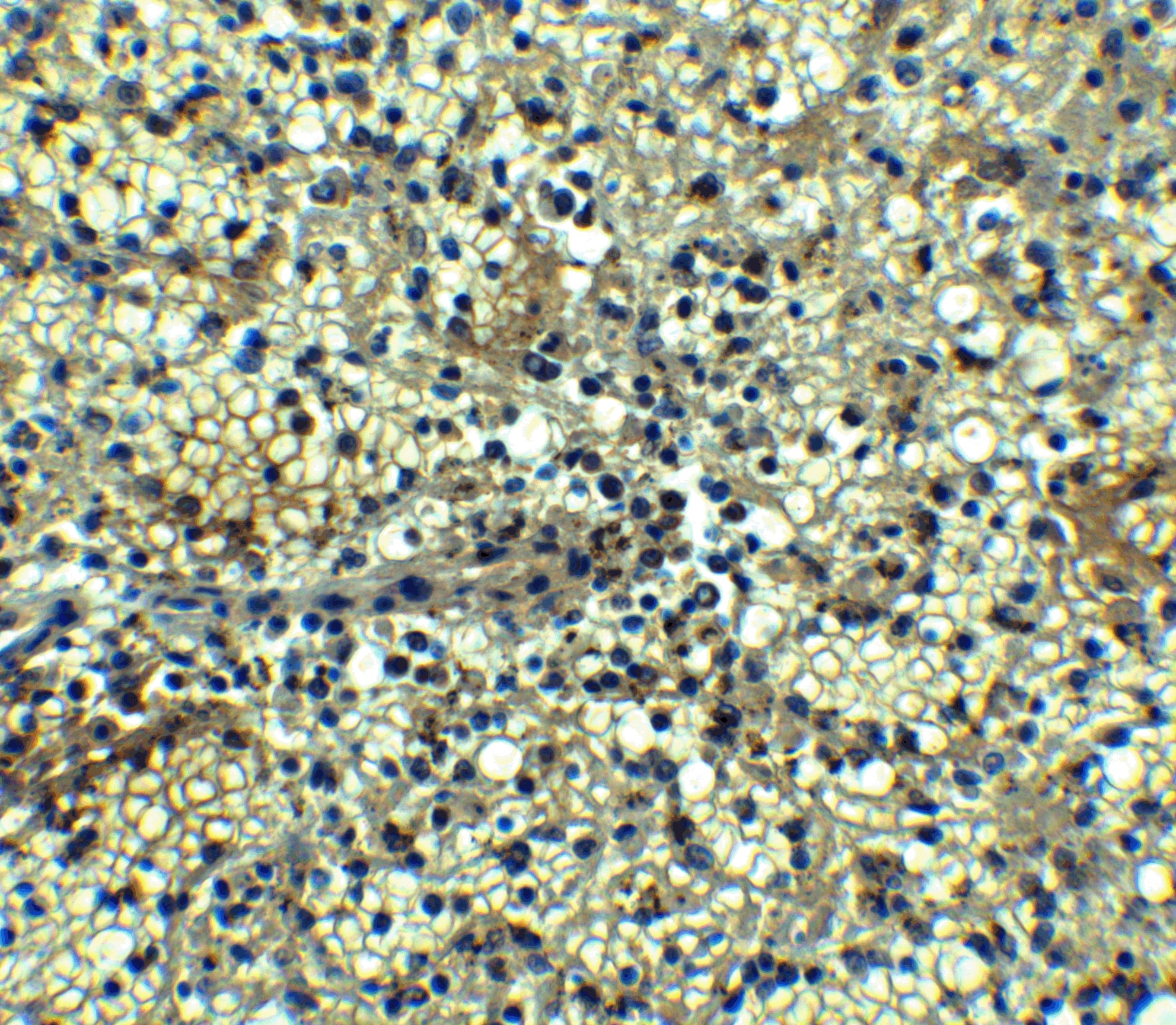 Immunohistochemistry: BCMA/TNFRSF17 Antibody - BSA Free [NBP1-76774] - Immunohistochemistry of BCMA/TNFRSF17 in human spleen tissue with BCMA/TNFRSF17 antibody at 5 ug/mL.