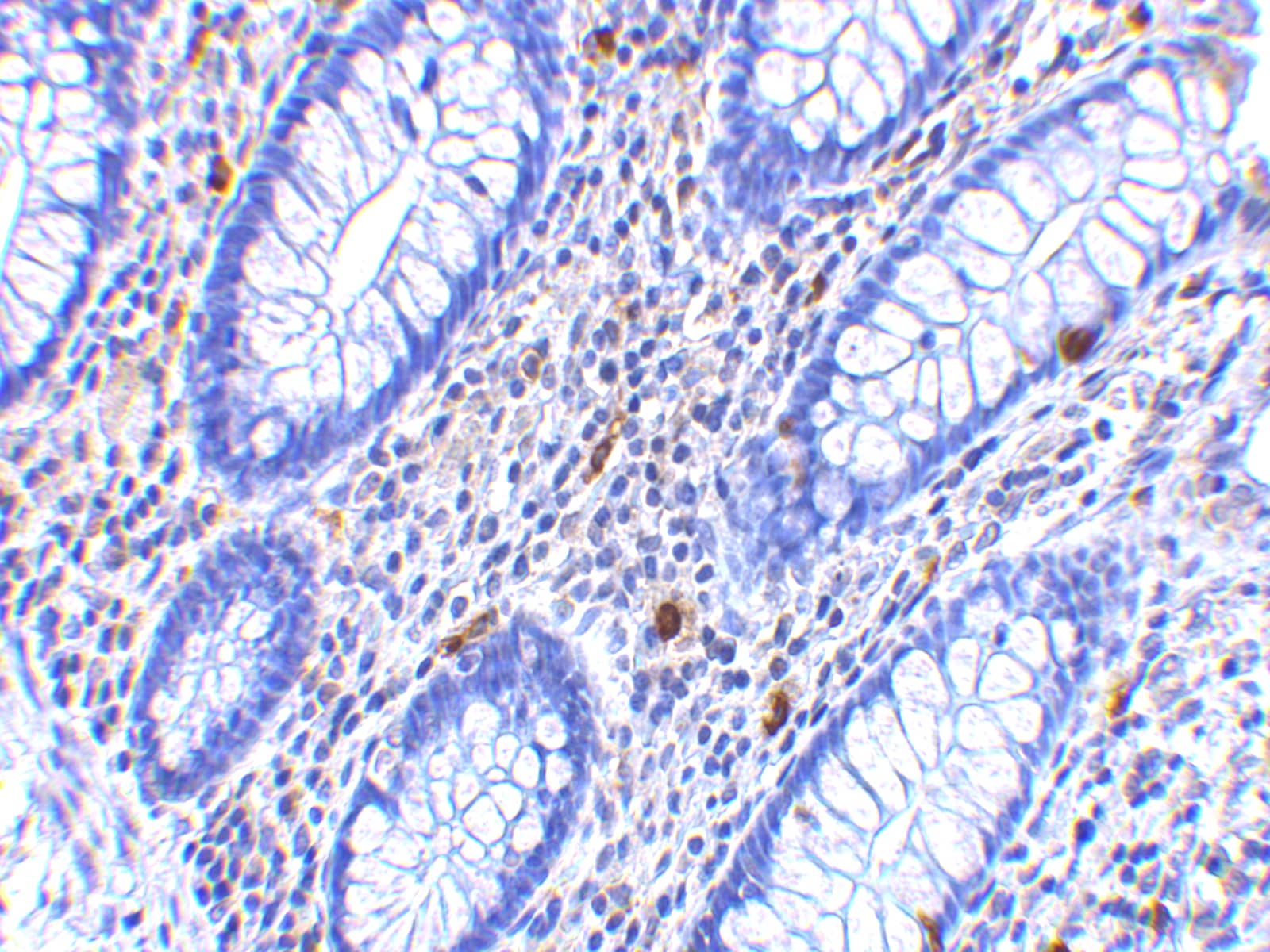 Immunohistochemistry: CD82/Kai-1 Antibody - BSA Free [NBP1-76775] - Immunohistochemistry of CD82/Kai-1 in human colon tissue with CD82/Kai-1 antibody at 2.5 u/mL.