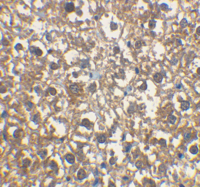 Immunohistochemistry: IRAK3 Antibody - BSA Free [NBP1-76782] - Immunohistochemical staining of rat liver tissue using IRAK3 antibody at 2 ug/mL.