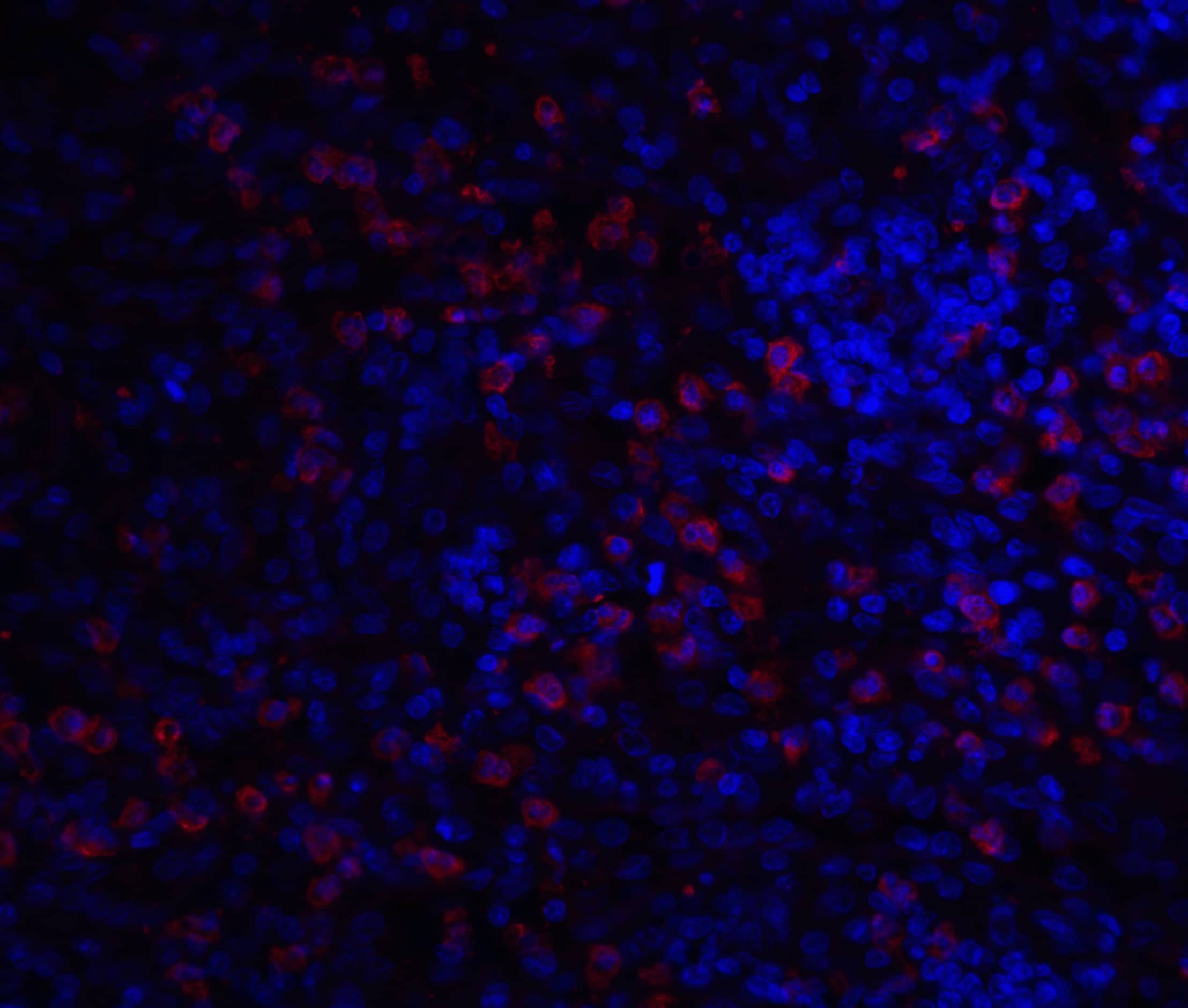 Immunocytochemistry/ Immunofluorescence: IRAK3 Antibody - BSA Free [NBP1-76782] - Immunofluorescence of IRAK2 in A20 cells with IRAK2 antibody at 20 ug/mL.Red: IRAK3 Antibody   Blue: DAPI staining