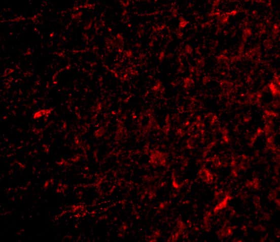 Immunocytochemistry/ Immunofluorescence: NPAS3 Antibody - BSA Free [NBP1-76786] - Immunofluorescence of NPAS3 in Human Brain cells with NPAS3 antibody at 20 ug/mL.