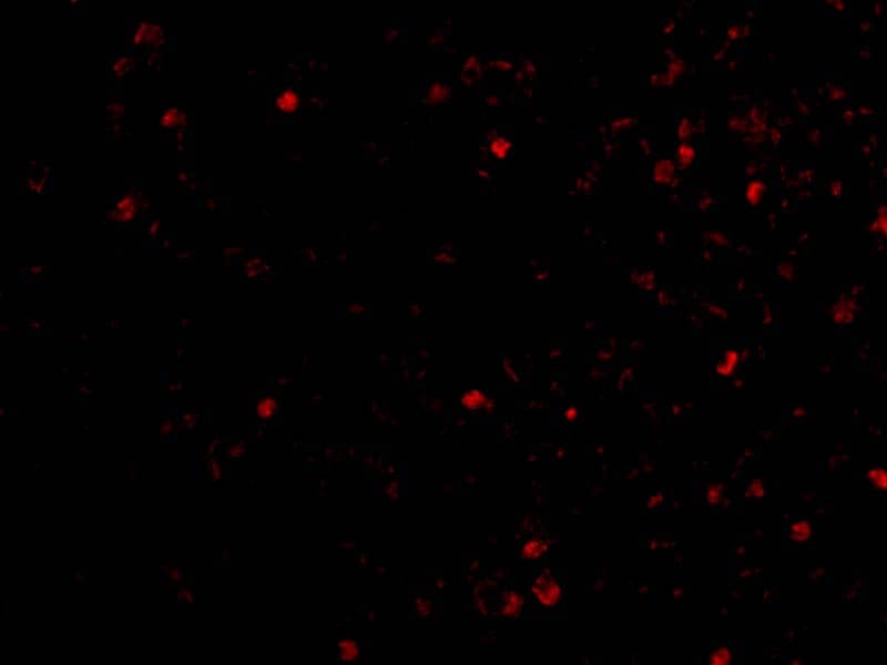 Immunocytochemistry/ Immunofluorescence: IKBKAP Antibody - BSA Free [NBP1-76788] - Immunofluorescence of IKBKAP in A20 cells with IKBKAP antibody at 20 ug/mL.