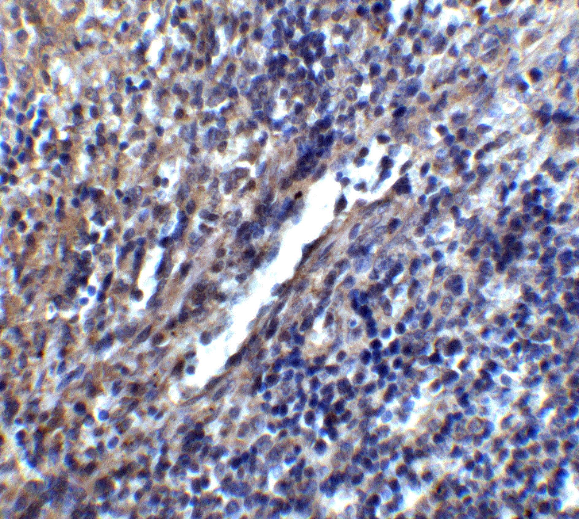 Immunohistochemistry: STIM1 Antibody - BSA Free [NBP1-76789] - Immunohistochemistry of STIM1 in mouse spleen tissue with STIM1 antibody at 5 u/ml.