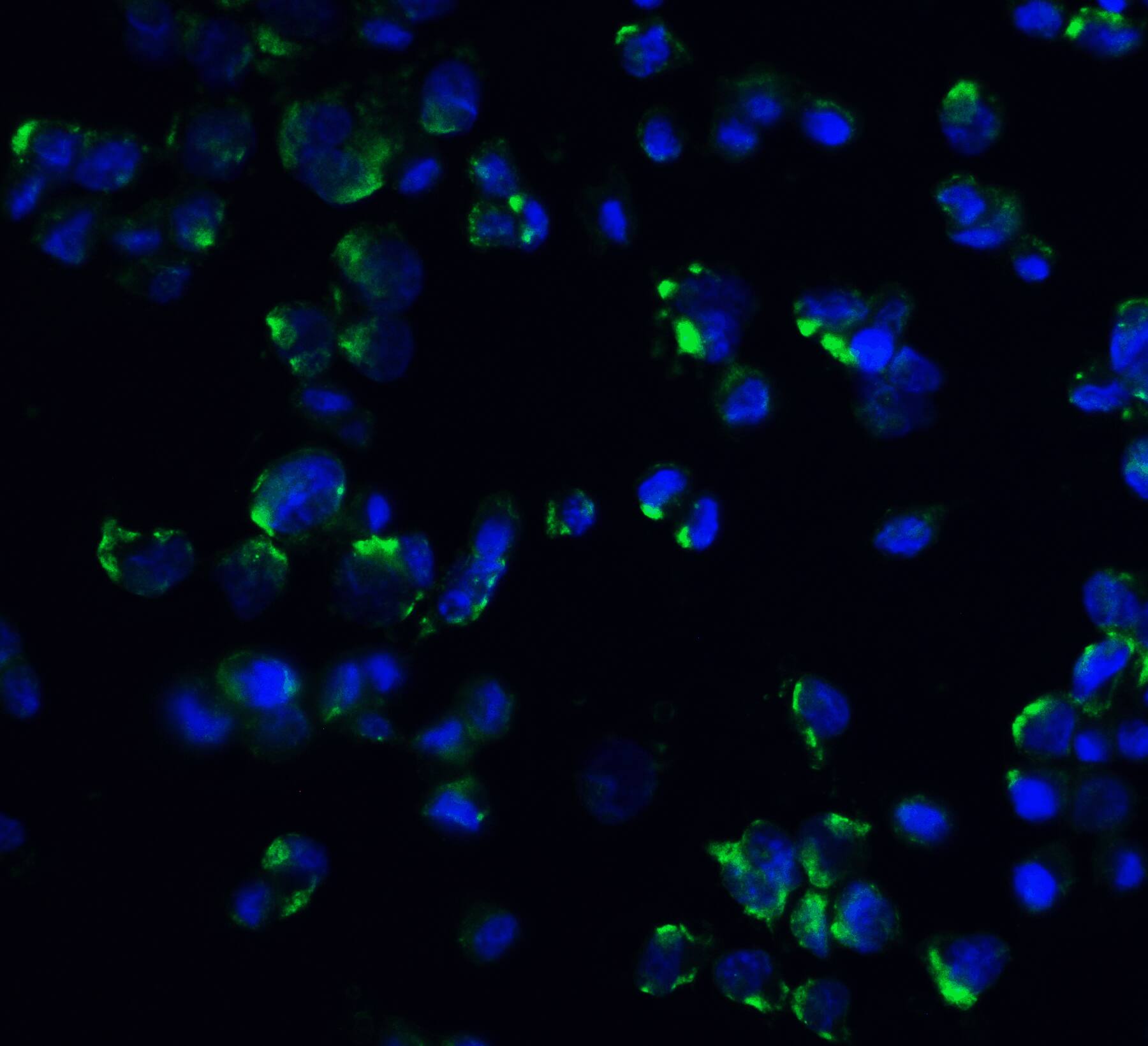 Immunocytochemistry/ Immunofluorescence: STIM1 Antibody - BSA Free [NBP1-76789] - Immunofluorescence of STIM1 in mouse spleen tissue with STIM1 antibody at 20 u/mL.Green: STIM1 Antibody   Blue: DAPI staining