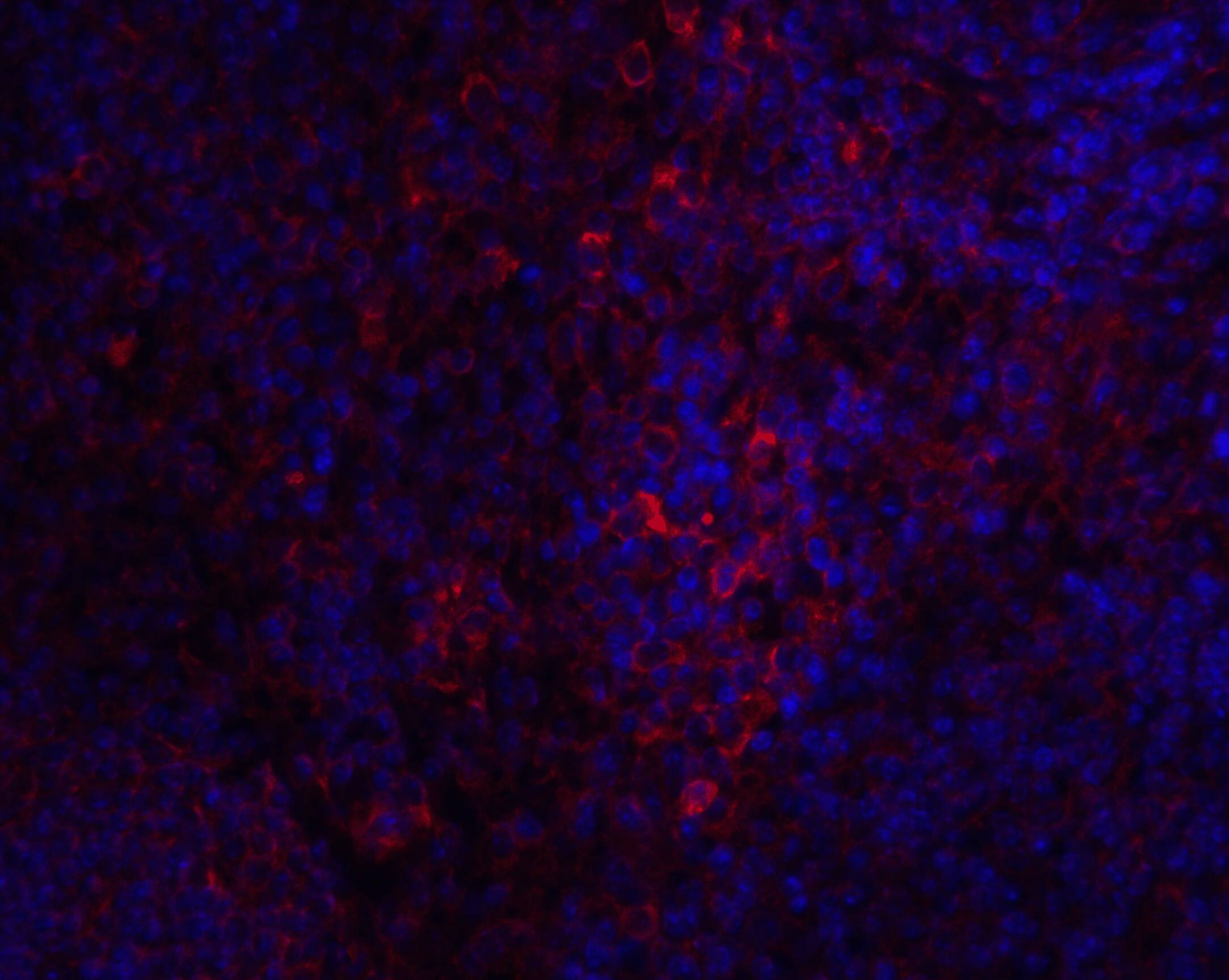 Immunocytochemistry/ Immunofluorescence: STIM1 Antibody - BSA Free [NBP1-76789] - Immunofluorescence of STIM1 in Hek293 cells with STIM1 antibody at 20 u/mL.Red: STIM1 Antibody   Blue: DAPI staining