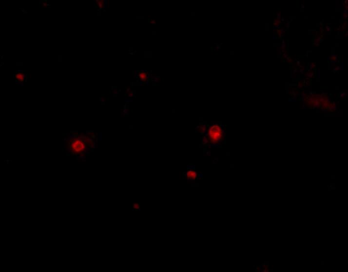 Immunocytochemistry/ Immunofluorescence STIM2 Antibody - BSA Free