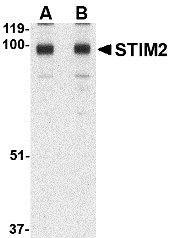 Western Blot: STIM2 Antibody - BSA Free [NBP1-76790] - Western blot analysis of STIM2 in A-20 cell lysate with STIM2 antibody at (A) 0.5 and (B) 1 u/mL.