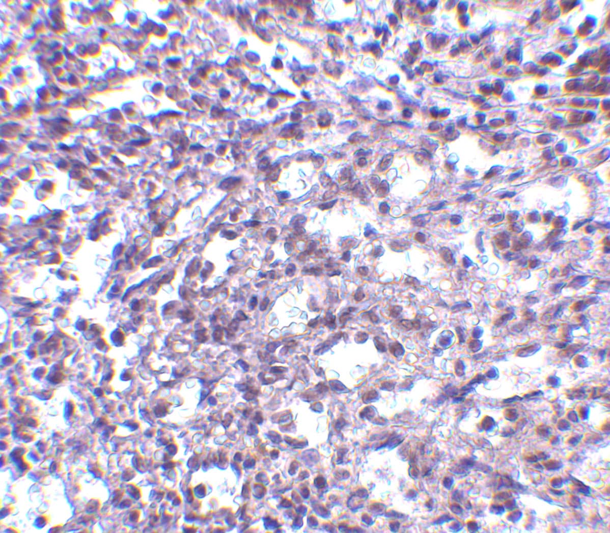 Immunohistochemistry: STIM2 Antibody - BSA Free [NBP1-76790] - Immunohistochemistry of STIM2 in human spleen tissue with STIM2 antibody at 2.5 u/mL.