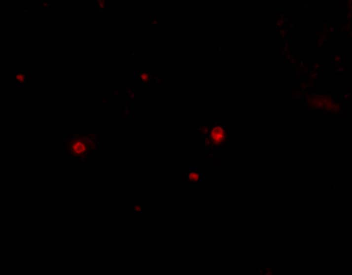 Immunocytochemistry/ Immunofluorescence: STIM2 Antibody - BSA Free [NBP1-76790] - Immunofluorescence of STIM2 in Human Spleen cells with STIM2 antibody at 20 u/mL.