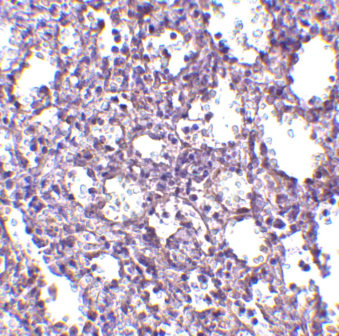 Immunohistochemistry: STIM2 Antibody - BSA Free [NBP1-76791] - Immunohistochemistry of STIM2 in human spleen tissue with STIM2 antibody at 2.5 u/mL.