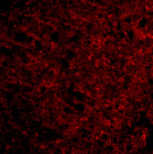 Immunocytochemistry/ Immunofluorescence: Presenilin-1 Antibody - BSA Free [NBP1-76792] - Immunofluorescence of Presenilin-1 in Human Brain cells with Presenilin-1 antibody at 20 u/mL.