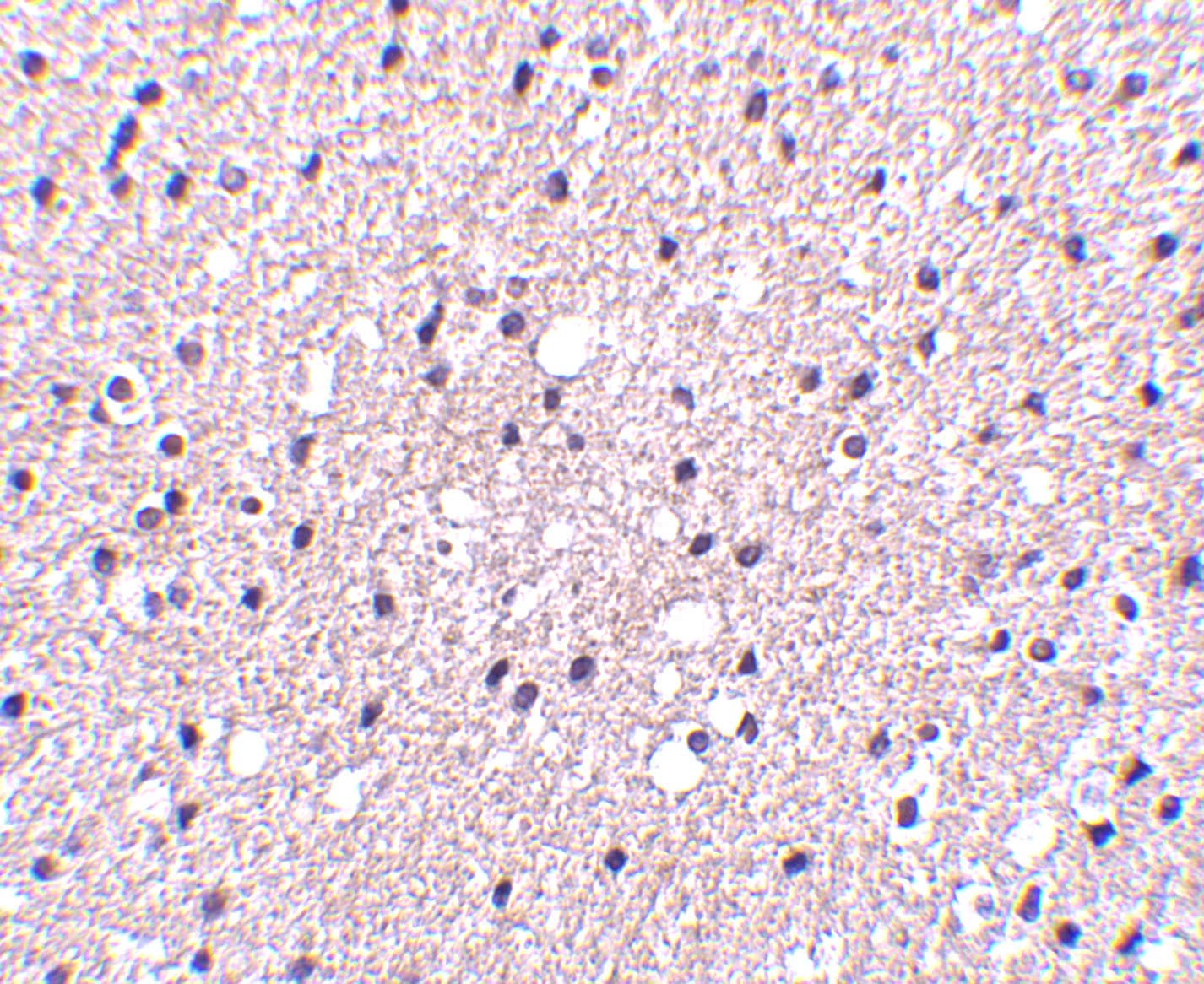 Immunohistochemistry: Presenilin-1 Antibody - BSA Free [NBP1-76792] - Immunohistochemistry of Presenilin-1 in human brain tissue with Presenilin-1 antibody at 2.5 u/mL.