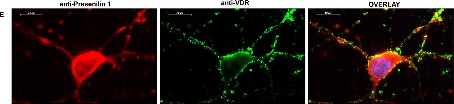Cell surface staining of VDR (green) on live neurons followed by fixation and immunofluorescence labeling of target proteins (100x): A) ADAM10; B) APP; C) BACE1; D) Nicastrin; E) Presenilin 1; F) Presenilin 2. Overlay images indicate the possible co-localization of VDR/ADAM10 (A) or VDR/APP (B) or VDR/Nicastrin (D) or limited co-localization of VDR/ Presenilin 1 (E) on the neuronal plasma membrane. Overlay images do not indicate co-localization for VDR/BACE1 (C) or VDR/Presenilin 2 (F) on the neuronal plasma membrane. Image collected and cropped by CiteAb from the following open publication (//pubmed.ncbi.nlm.nih.gov/29176823), licensed under a CC-BY license. Not internally tested by Novus Biologicals.