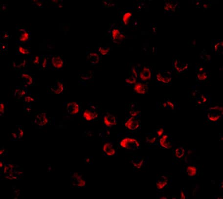 Immunocytochemistry/ Immunofluorescence: HUWE1 Antibody - BSA Free [NBP1-76795] - Immunofluorescence of HUWE1 in Daudi cells with HUWE1 antibody at 20 ug/mL.