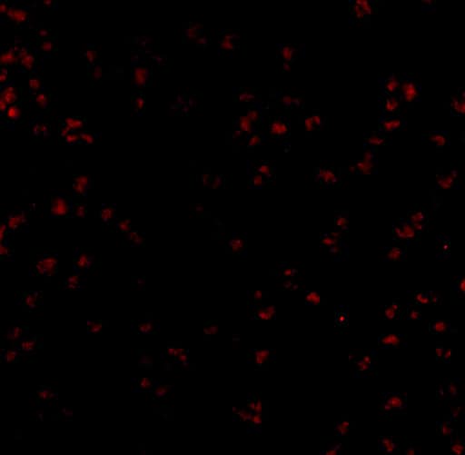 Immunocytochemistry/ Immunofluorescence: Bub1 Antibody - BSA Free [NBP1-76797] - Immunofluorescence of Bub1 in A20 cells with Bub1 antibody at 20 u/mL.