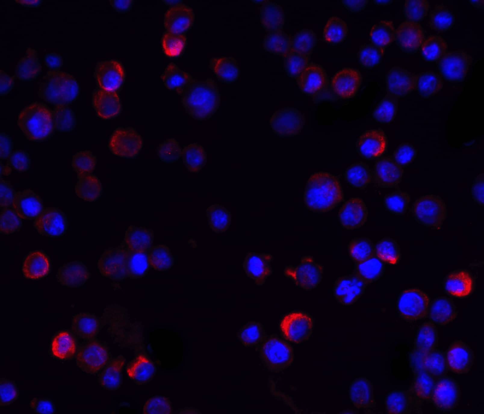 Immunocytochemistry/ Immunofluorescence: IKK gamma Antibody - BSA Free [NBP1-76799] - Immunofluorescence of IKK gamma in Hela cells with IKK gamma antibody at 20 u/mL.Red: IKK gamma Antibody   Blue: DAPI staining