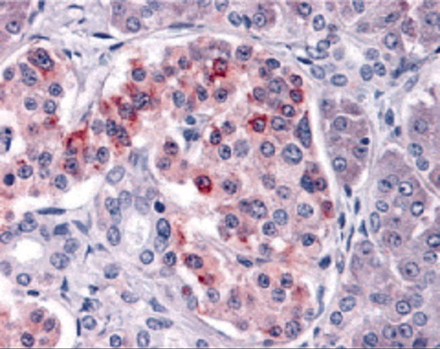 Immunohistochemistry: IKK epsilon/IKBKE Antibody - BSA Free [NBP1-76800] - Validation of IKK epsilon in Human Pancreas Tissue. Immunohistochemical analysis of paraffin-embedded human pancreas tissue using anti-IKK epsilon antibody  at 10 ug/ml. Tissue was fixed with formaldehyde and blocked with 10% serum for 1h at RT; antigen retrieval was by heat mediation with a citrate buffer (pH6). Samples were incubated with primary antibody overnight at 4C. A goat anti-rabbit IgG H&L (HRP) at 1/250 was used as secondary. Counter stained with Hematoxylin.