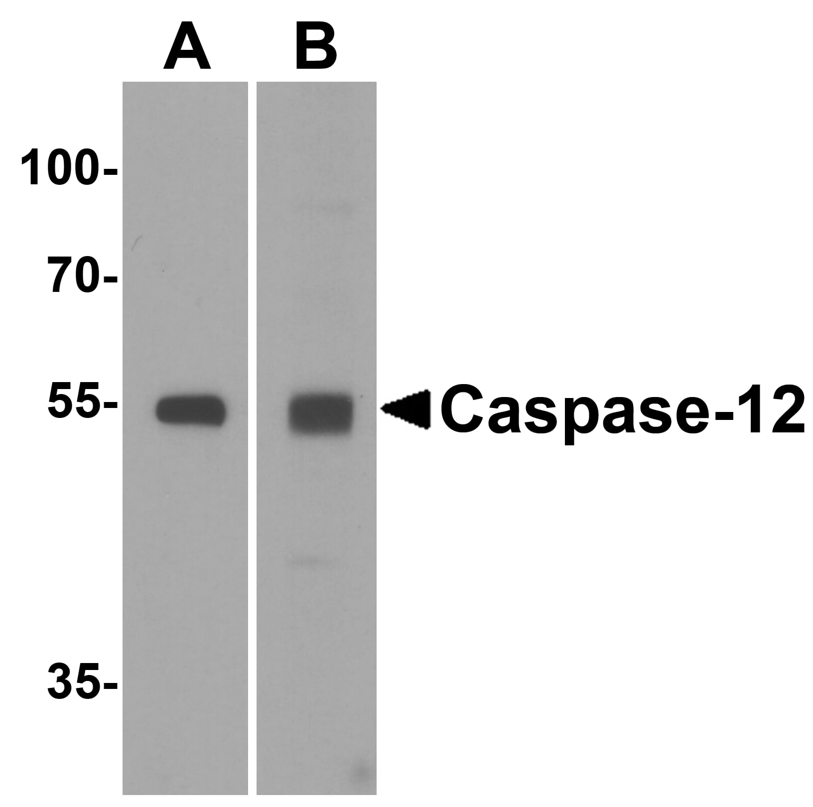 Western Blot: Caspase-12 Antibody - BSA Free [NBP1-76801] - Western blot analysis of Caspase-12 in (A) human spleen and (B) mouse spleen tissue lysate with Caspase-12 antibody at 1 u/mL.