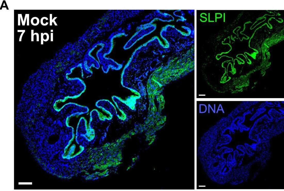 SLPI is expressed in the bladder epithelium. (A and B) Immunofluorescence staining of SLPI protein expression (green) and DNA using Hoechst stain (blue) in mock-infected (A) and infected (B) bladders from Slpi+/+ mice. Left panels (5× magnification, 200 um scale bars) are merged images of SLPI and DNA shown as smaller panels on the right. (C–E) Mean fluorescence intensity (MFI) of mock and infected bladder epithelium for DNA (C) and SLPI (D) with MFI ratio of SLPI/DNA (E) (Student’s t test). (F) Comparison of supernatant SLPI levels in control (PBS) or infected (UTI89) 5637 bladder epithelial cells represented as percent of starting SLPI in each well. (G) Fold change in Slpi transcription as measured by qRT-PCR in 5637 cells at 2 hpi. For panels F and G, shapes denote separate biological replicate experiments, each point represents the average of 4 or more individual wells (paired Student’s t test). Image collected and cropped by CiteAb from the following open publication (//pubmed.ncbi.nlm.nih.gov/38270443), licensed under a CC-BY license. Not internally tested by Novus Biologicals.