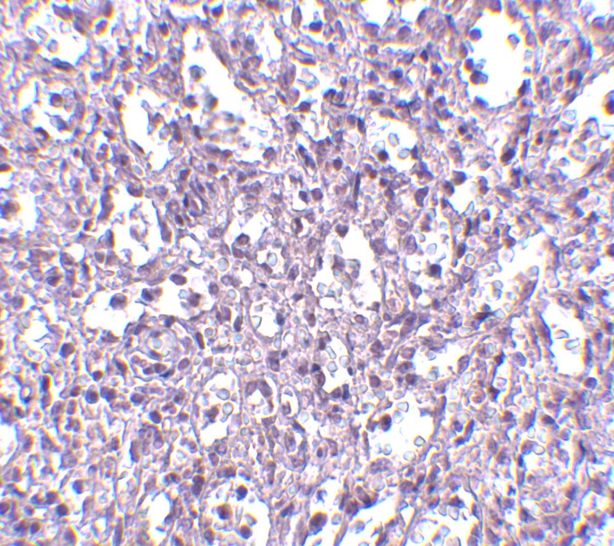 Immunohistochemistry: carabin Antibody - BSA Free [NBP1-76806] - Immunohistochemistry of carabin in human spleen tissue with carabin antibody at 2.5 ug/mL.