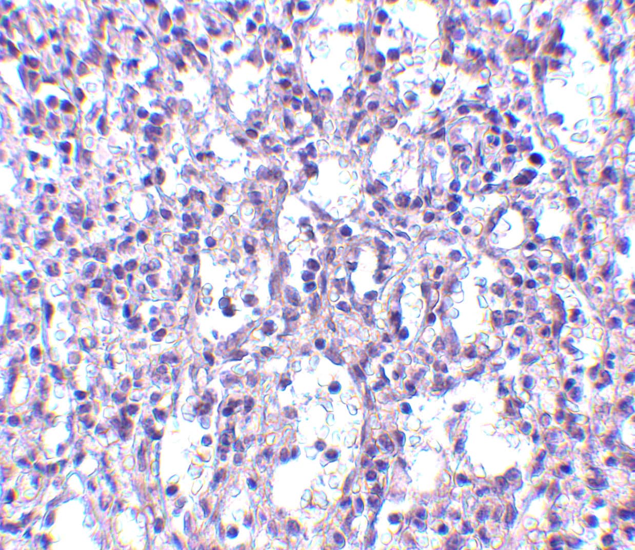 Immunohistochemistry: carabin Antibody - BSA Free [NBP1-76807] - Immunohistochemistry of carabin in human spleen tissue with carabin antibody at 2.5 ug/mL.