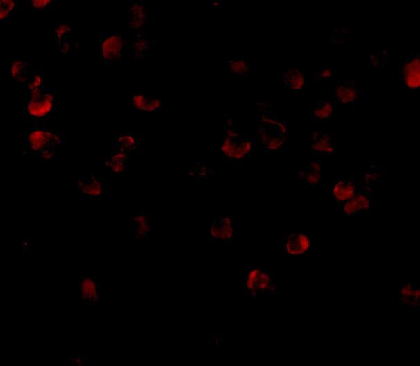 Immunocytochemistry/ Immunofluorescence: FYB/ADAP/SLAP130 Antibody - BSA Free [NBP1-76811] - Immunofluorescence of FYB/ADAP/SLAP130 in K562 cells with FYB/ADAP/SLAP130 antibody at 20 ug/mL.