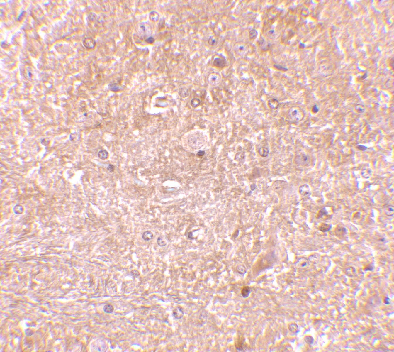 Immunohistochemistry: Caspase-13 Antibody - BSA Free [NBP1-76812] - Immunohistochemistry of caspase-13 in mouse brain tissue with caspase-13 antibody at 10 u/mL.