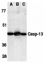 Western Blot: Caspase-13 Antibody - BSA Free [NBP1-76812] - Western blot analysis of Caspase-13 in human HL60 cell lysate (A), mouse brain (B) and rat brain (C) tissue lysates with Caspase-13 antibody at 1 u/mL.