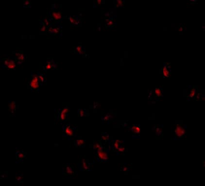 Immunocytochemistry/ Immunofluorescence: LIS1 Antibody - BSA Free [NBP1-76815] - Immunofluorescence of LIS1 in Jurkat cells with LIS1 antibody at 20 u/mL.