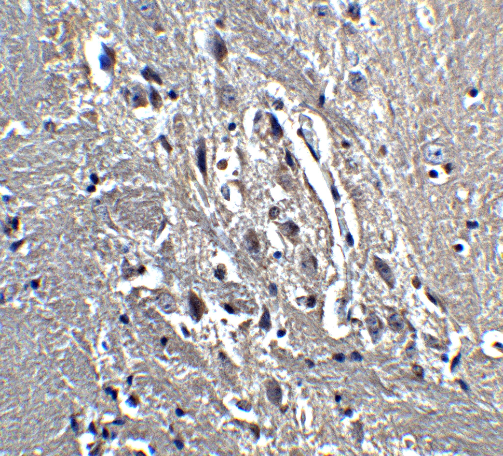 Immunohistochemistry Kinesin 5A Antibody - BSA Free