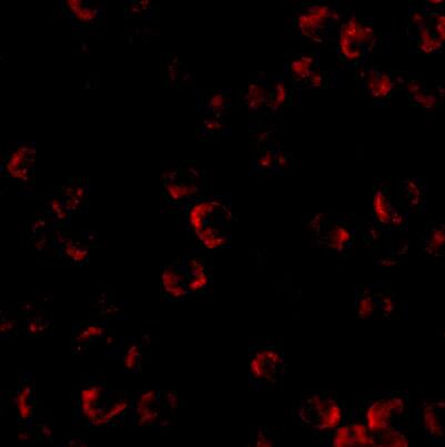 Immunocytochemistry/ Immunofluorescence: Kinesin 5A Antibody - BSA Free [NBP1-76816] - Immunofluorescence of Kinesin 5A in K562 cells with Kinesin 5A antibody at 20 u/mL.