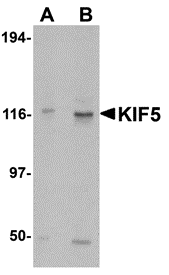 Western Blot: Kinesin 5A Antibody - BSA Free [NBP1-76816] - Western blot analysis of Kinesin 5A in K562 cell lysate with Kinesin 5A antibody at (A) 0.5 and (B) 1 u/mL.