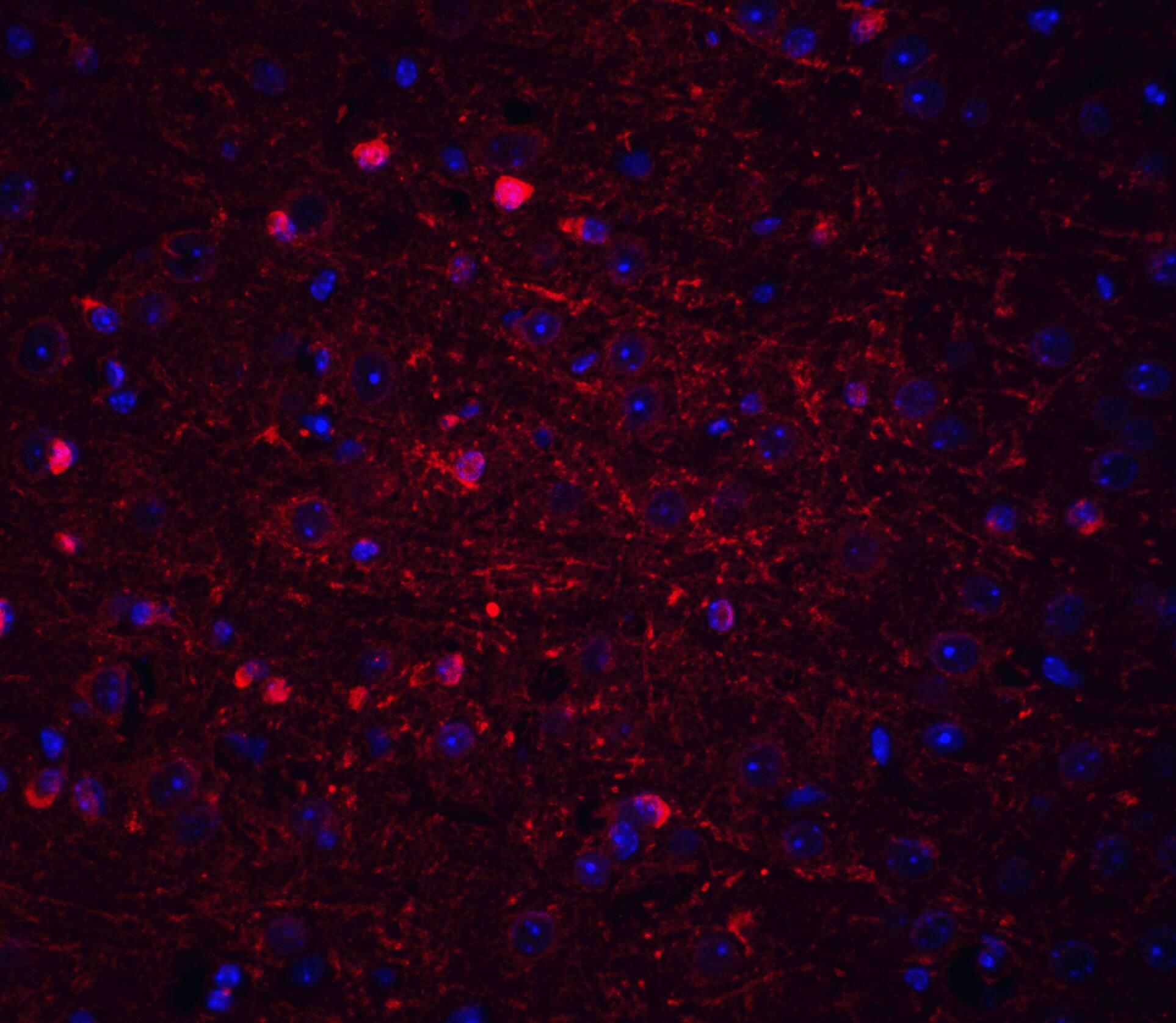 Immunocytochemistry/ Immunofluorescence: Kinesin 5A Antibody - BSA Free [NBP1-76816] - Immunofluorescence of Kinesin 5A in mouse brain tissue with Kinesin 5A antibody at 20 u/mL.Red: Kinesin 5A Antibody   Blue: DAPI staining