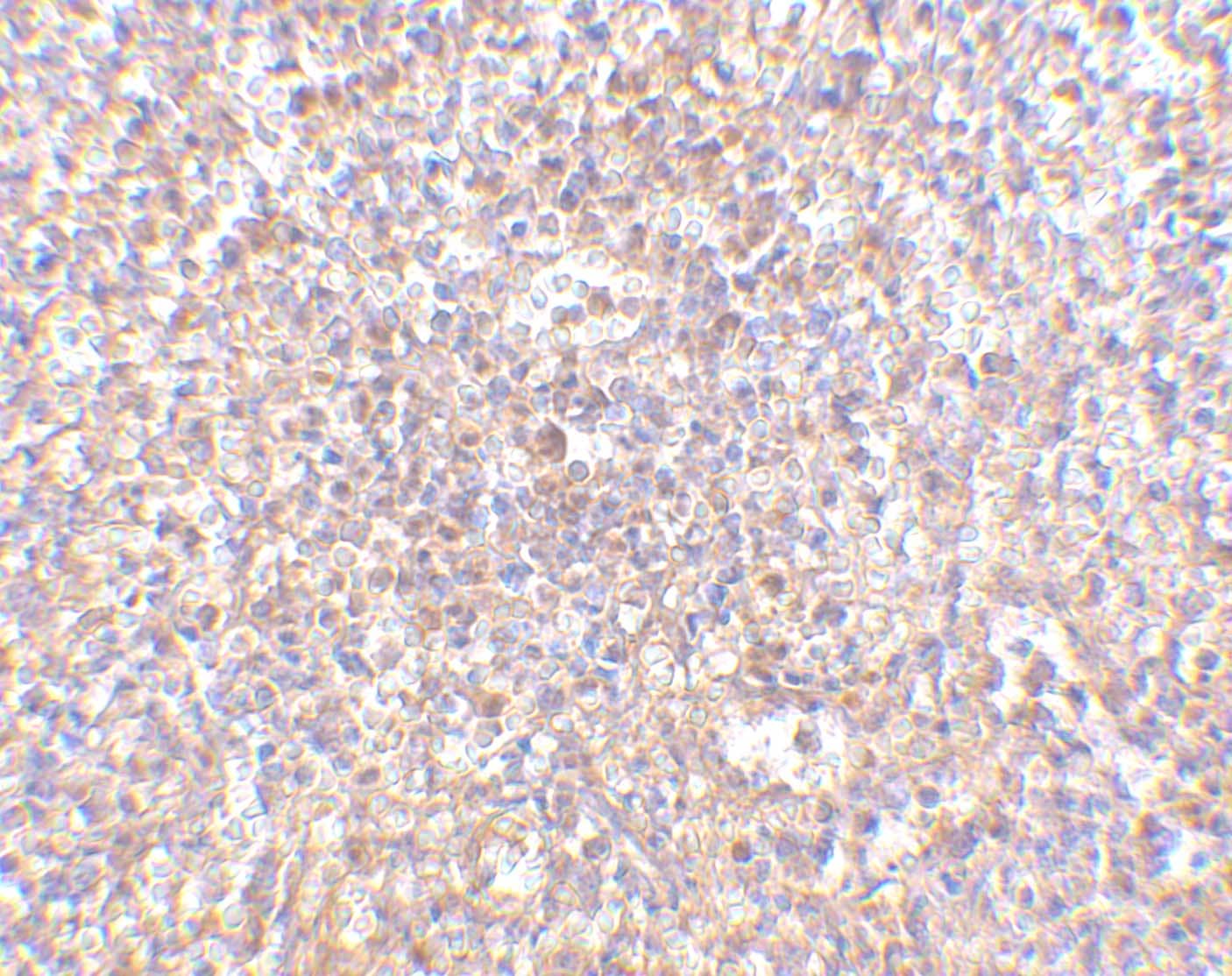 Immunohistochemistry: STEAP1 Antibody - BSA Free [NBP1-76821] - Immunohistochemistry of STEAP1 in human spleen tissue with STEAP1 antibody at 2.5 ug/mL.