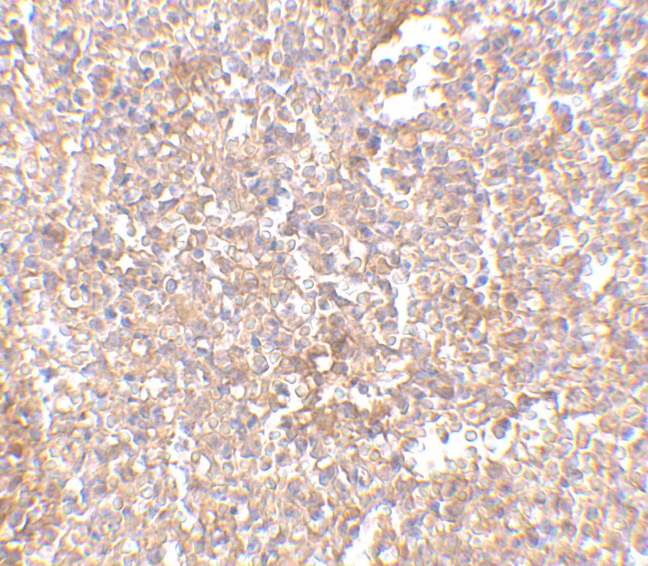 Immunohistochemistry STEAP1 Antibody - BSA Free