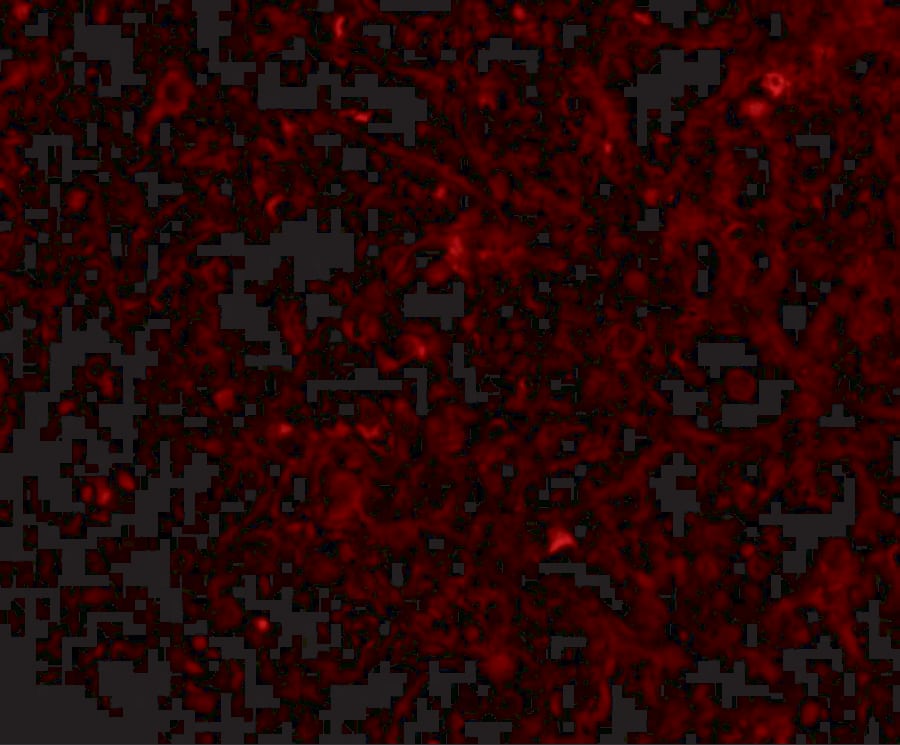 Immunocytochemistry/ Immunofluorescence: STEAP1 Antibody - BSA Free [NBP1-76822] - Immunofluorescence of STEAP1 in human spleen tissue with STEAP1 antibody at 20 ug/mL.