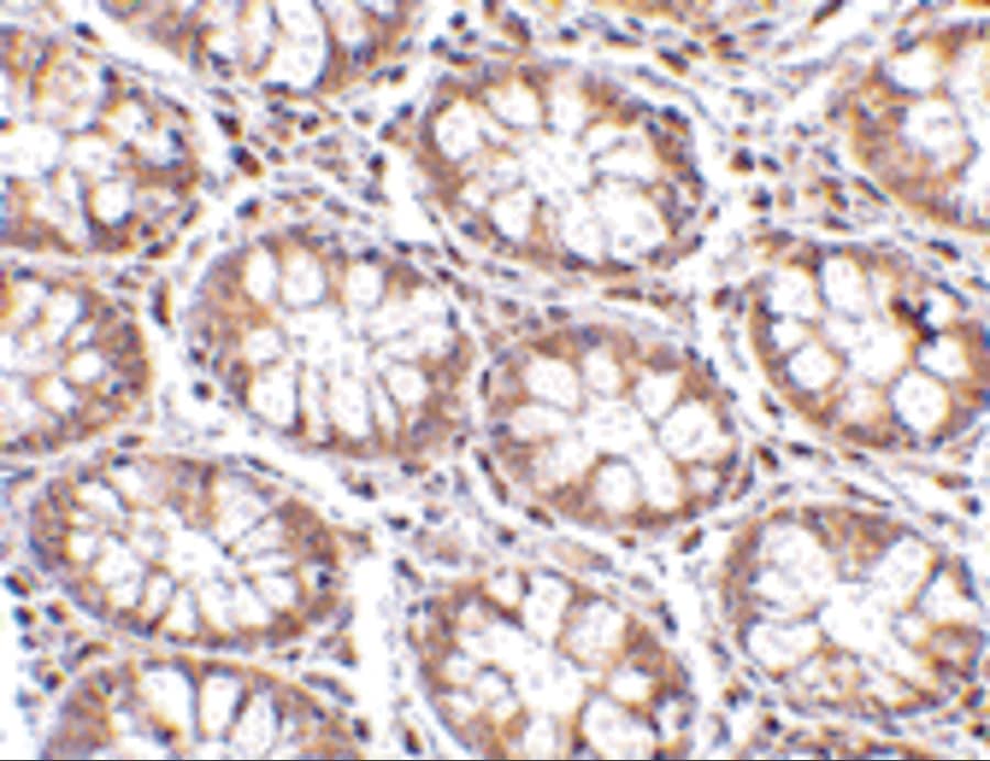 Immunohistochemistry STEAP2 Antibody - BSA Free