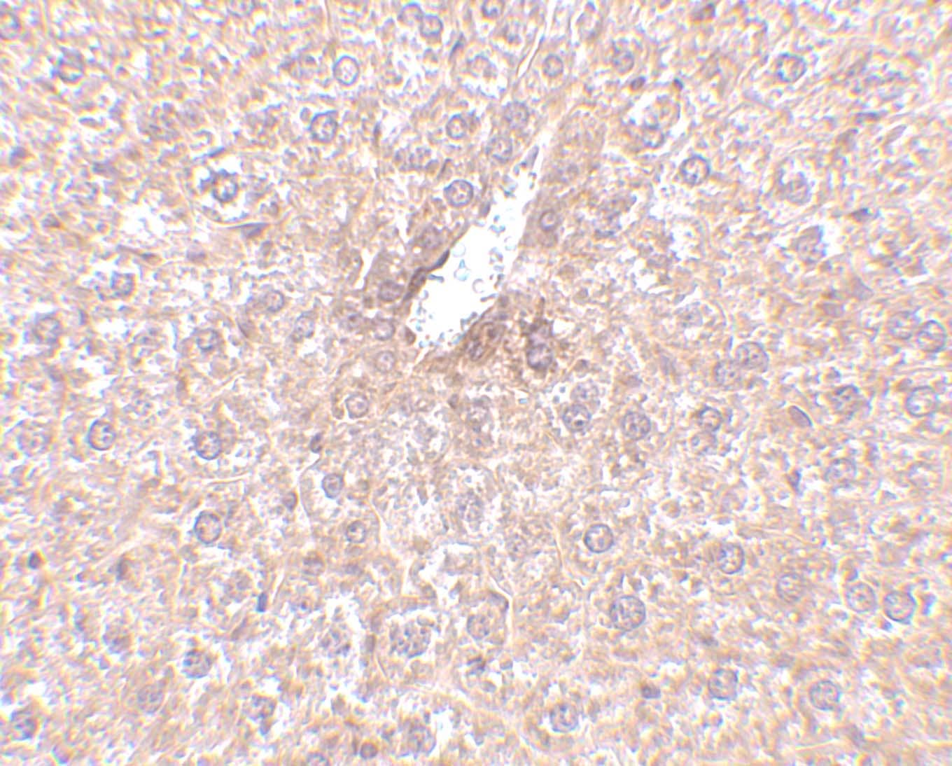 Immunohistochemistry: STEAP3/TSAP6 Antibody - BSA Free [NBP1-76824] - Immunohistochemistry of STEAP3/TSAP6 in mouse liver tissue with STEAP3/TSAP6 antibody at 2.5 ug/mL.